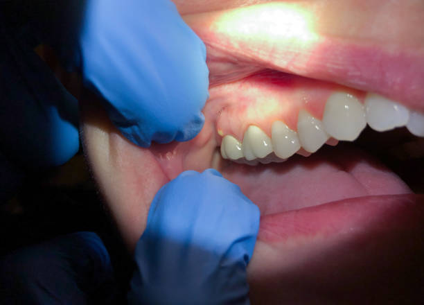 Best Emergency Dentist for Knocked-Out Tooth in Seaside Park, NJ